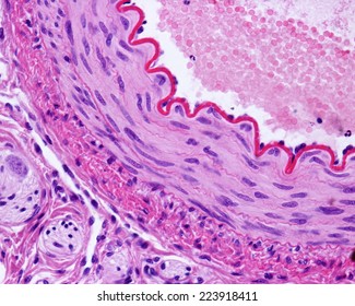 Light Micrograph Of A Cross-sectioned Muscular Artery, Showing A Thick And Wavy Internal Elastic Lamina, A Middle Layer With Smooth Muscle Fibers, And An Outer Connective Tissue Adventitia. H&E Stain 