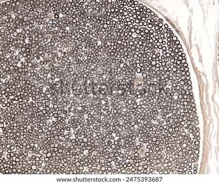 Light micrograph of a cross-sectioned myelinated nerve stained with osmium tetroxyde to show the myelin sheath of nerve fibers. 
