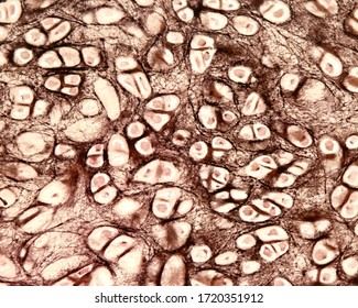 Light Micrograph Of Elastic Cartilage Of A Human Epiglottis Stained With Verhoeff’s Iron Hematoxylin. Elastic Fibres Are Visible In The Cartilage Matrix. The Perichondrium At Right.