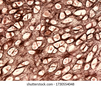 Light Micrograph Of Elastic Cartilage Of A Human Epiglottis Stained With Verhoeff’s Iron Hematoxylin. Elastic Fibres Are Visible In The Cartilage Matrix. The Perichondrium At Right.