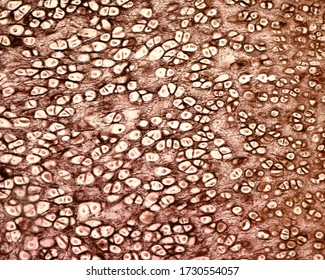 Light Micrograph Of Elastic Cartilage Of A Human Epiglottis Stained With Verhoeff’s Iron Hematoxylin. Elastic Fibres Are Visible In The Cartilage Matrix. The Perichondrium At Right.