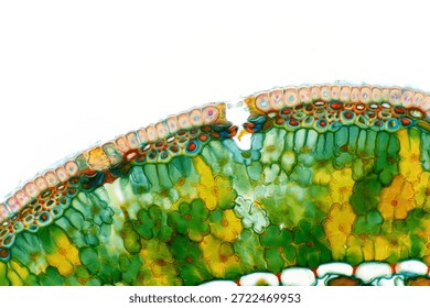 Light micrograph of the epidermis of a black pine (Pinus nigra) needle, showing sunken stomata embedded within the epidermal tissue. Characteristic conifer leaf adaptation for regulating gas exchange and reducing water loss. Captured at 200x magnification with an Olympus BH2 microscope.