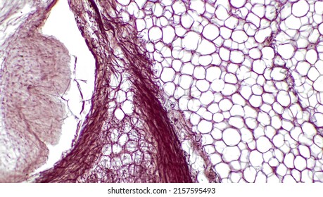 Light micrograph of epithelial tissue from the skin. Subcutaneous fat layer of skin. The large holes correspond to white adipocytes. Hematoxylin and Eosin Staining.