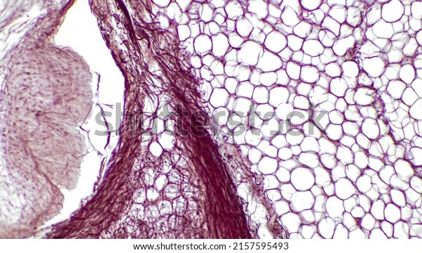 Light micrograph of\
epithelial tissue from the skin. Subcutaneous fat layer of skin.\
The large holes correspond to white adipocytes. Hematoxylin and\
Eosin Staining.
