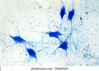 Light Micrograph Of Human Brain Tissue Showing Neurons And Glial Cells