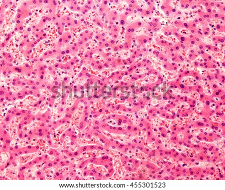 Light micrograph of a human liver stained with HE. The hepatocytes are arranged in cords separated by clear areas where hepatic sinusoids showing red blood cells are located.
