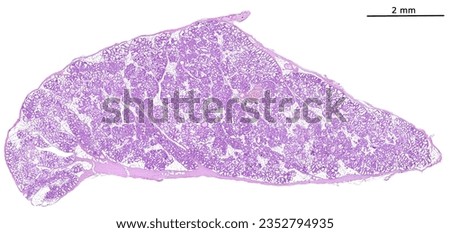 Light micrograph of a lactating breast. There are numerous round alveoli, with their lumens occupied by the secretory product (milk).