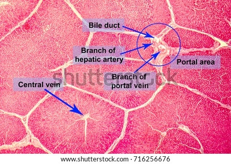 Light micrograph of a liver showing hepatic lobules and portal areas with hepatic duct, branches of portal vein and hepatic artery