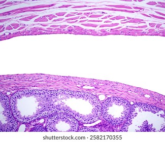 Light micrograph of a rabbit testicle showing, from right, seminiferous tubules, fibrous tunica albuginea, visceral and parietal layers of tunica vaginalis and muscle fibers of cremaster muscle.