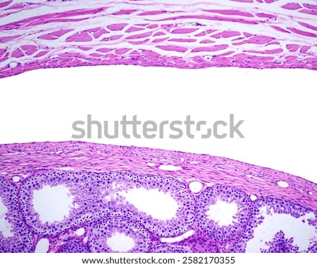 Light micrograph of a rabbit testicle showing, from right, seminiferous tubules, fibrous tunica albuginea, visceral and parietal layers of tunica vaginalis and muscle fibers of cremaster muscle.