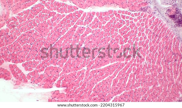 Light micrograph of a section through skeletal\
muscle. Muscle fibre fascicles. Haematoxylin end eosin stain.\
Magnification: x200