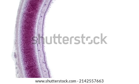 Light micrograph of a section through the trachea, or windpipe, the tube leading from the mouth to the bronchus and the lungs. The tracheal cavity is lined with respiratory epithelium.