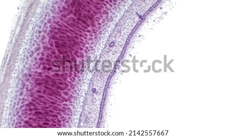 Light micrograph of a section through the trachea, or windpipe, the tube leading from the mouth to the bronchus and the lungs. The tracheal cavity is lined with respiratory epithelium.