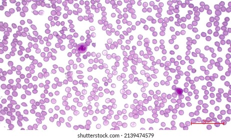 Light micrograph showing human blood cells (Blood smear). Erythrocytes  make up the majority of blood cells.  Two types of white blood cell (purple) - neutrophil and lymphocyt.   Magnification: x600.