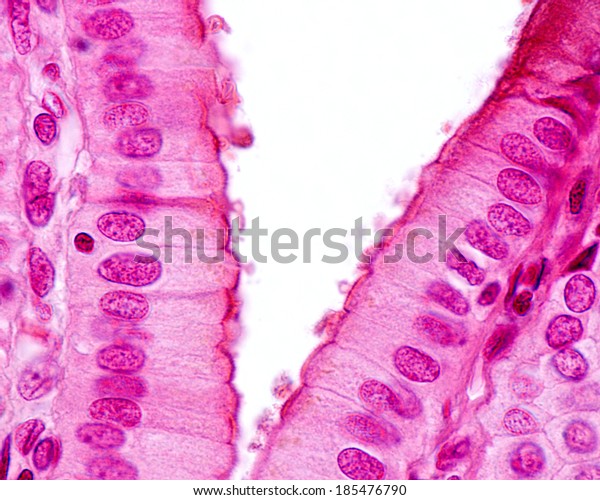 Light Micrograph Showing Simple Columnar Epithelium Stock Photo ...