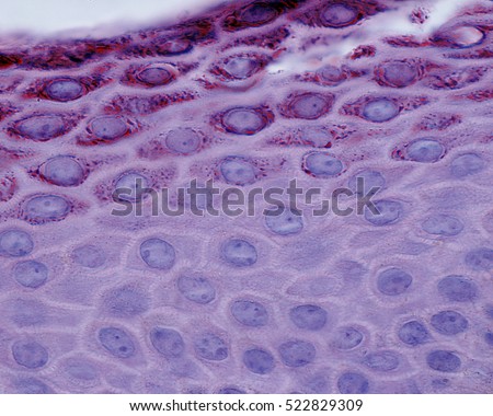 Light micrograph showing the stratum spinosum (bottom) and the stratum granulosum (granular layer) of the skin epidermis.
