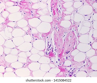 Light Micrograph Of White Adipose Tissue Stained With Hematoxylin And Eosin. Adipocytes (fat Cells) Contains A Large Lipid Droplet.