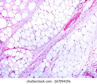Light micrograph of white adipose tissue. Adipocytes (fat cells) contain a large lipid droplet. The structures that traverse diagonally the image are connective tissue septa. H&E stain