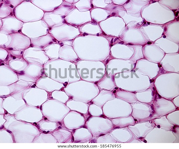 Light micrograph of white adipose tissue stained\
with hematoxylin and eosin. Adipocytes (fat cells) contains a large\
lipid droplet.