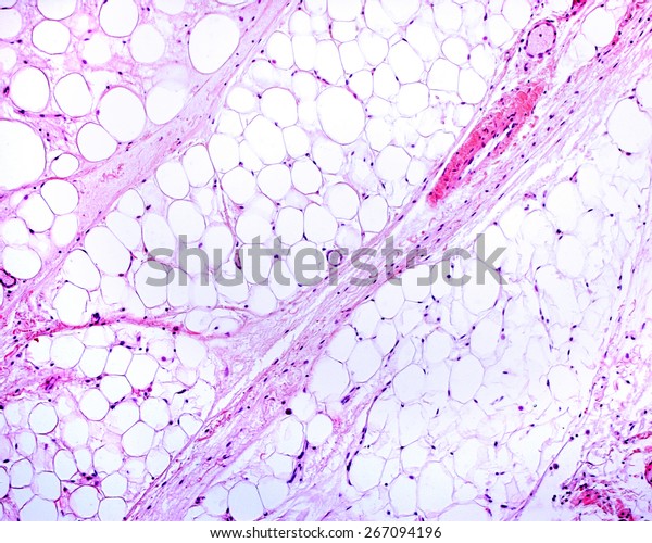 Light\
micrograph of white adipose tissue. Adipocytes (fat cells) contain\
a large lipid droplet. The structures that traverse diagonally the\
image are connective tissue septa. H&E\
stain