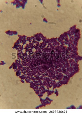 A light microscope image displays a microbial smear with clusters of cocci (spherical bacteria) that are stained a deep purple and violet