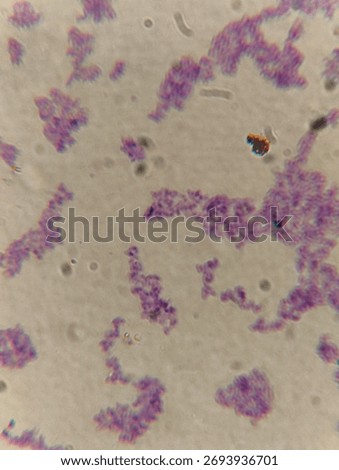 A light microscope image displays a microbial smear with clusters of cocci (spherical bacteria) that are stained a deep purple and violet