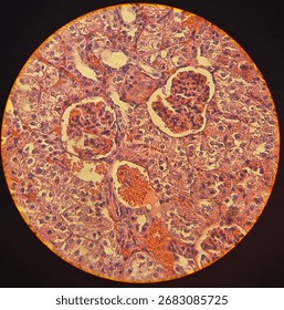 Light microscope image of human kidney tissue showing renal corpuscles, glomeruli, and tubules. Histology slide for medical science, anatomy, biology, and healthcare education.