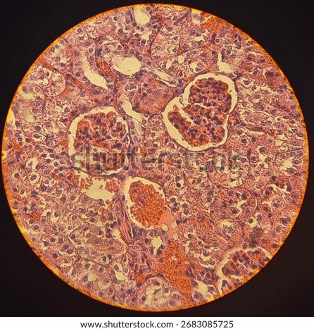 Light microscope image of human kidney tissue showing renal corpuscles, glomeruli, and tubules. Histology slide for medical science, anatomy, biology, and healthcare education.