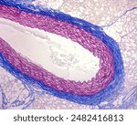 Light microscope micrograph of an elastic stained with the Cajal-Gallego method. The elastic lamellae are stained in pink colour and the collagen fibers of adventitia in blue colour.