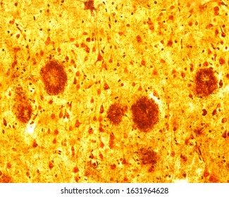 Light Microscope Micrograph Human Cerebral Cortex Stock Photo ...