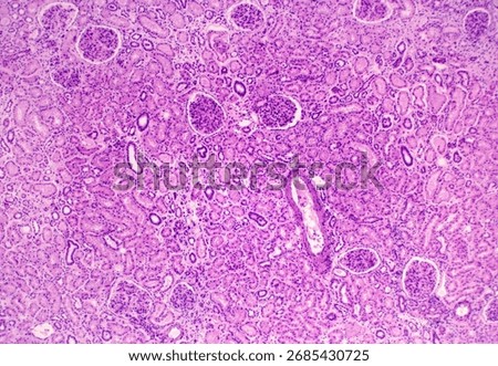Light microscope micrograph of renal cortex showing its components: glomeruli or renal corpuscles, renal convoluted tubules and blood vessels. 