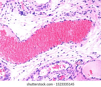 Arterioles Images, Stock Photos & Vectors | Shutterstock