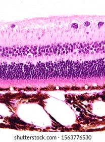 Light Microscope Micrograph Showing The Retina And Choroid. From Top To Bottom, All The Retina Layers Can Be Seen. Outside The Pigment Epithelium, The Pigmented Choroid Shows Dilated Blood Vessels