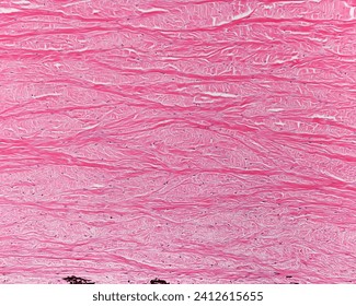 Light microscope micrograph showing the sclera, a dense connective tissue with abundant collagen fibers. On the bottom, there are some pigmented cells. Is the lamina fusca or suprachoroid lamina
