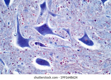 Light Microscope Of Motor Neurons Of The Spinal Cord Are Part Of The Central Nervous System. Haematoxylin And Eosin Staining Technique For Human Tissue.