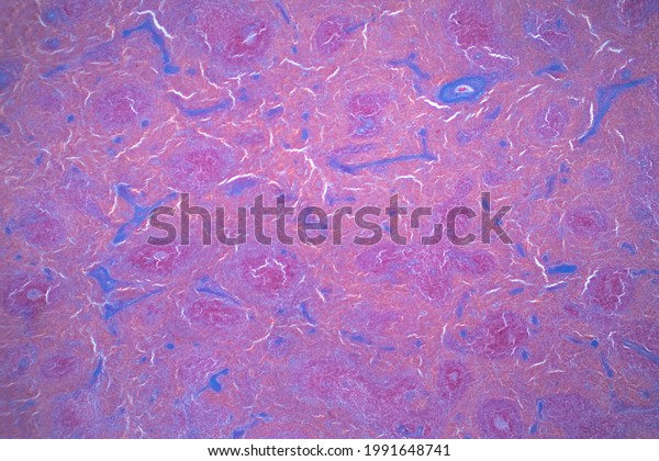 Light microscope of Spleen\
histology for education. The spleen is the largest mass of\
lymphatic tissue in the body. Haematoxylin and eosin staining\
technique.