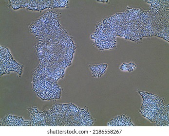 Light microscopic image of induced pluripotent stem cell populations proliferating in Petri dish. Biological imaging of cell clusters in cell medium.  - Shutterstock ID 2186558267