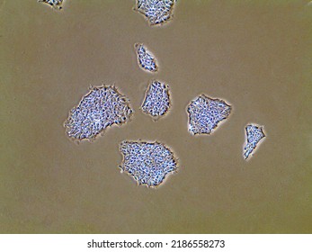 Light Microscopic Image Of Induced Pluripotent Stem Cell Populations Proliferating In Petri Dish. Biological Imaging Of Cell Clusters In Cell Medium. 