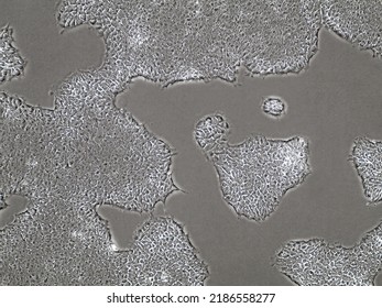 Light microscopic image of induced pluripotent stem cell populations proliferating and growing towards each other in Petri dish. Biological imaging of cell clusters in cell medium.  - Shutterstock ID 2186558277