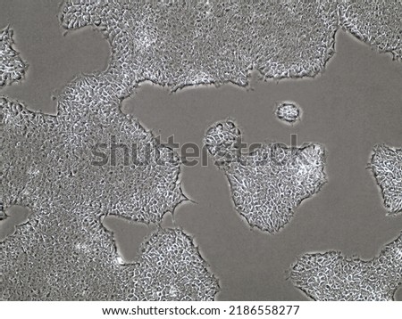 Light microscopic image of induced pluripotent stem cell populations proliferating and growing towards each other in Petri dish. Biological imaging of cell clusters in cell medium. 