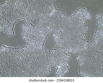 Light Microscopy Of Stem Cell Populations Growing Towards Each Other. Induced Pluripotent Stem Cell Migration In Petri Dish. Regenerative Medicine And Stem Cell Proliferation.