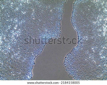 Light microscopy of stem cell populations growing towards each other. Induced pluripotent stem cell migration in Petri dish. Regenerative medicine and stem cell proliferation.