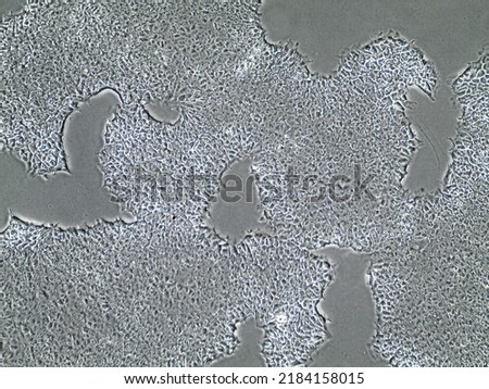 Light microscopy of stem cell populations growing towards each other. Induced pluripotent stem cell migration in Petri dish. Regenerative medicine and stem cell proliferation.