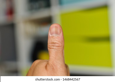 Lindenhof, Mannheim, Germany- August 2, 2019 : Close up of thumbnail with dark stripes or lines. - Powered by Shutterstock