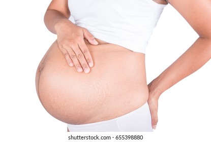 Linea Nigra And Stretch Marks On Pregnant Women