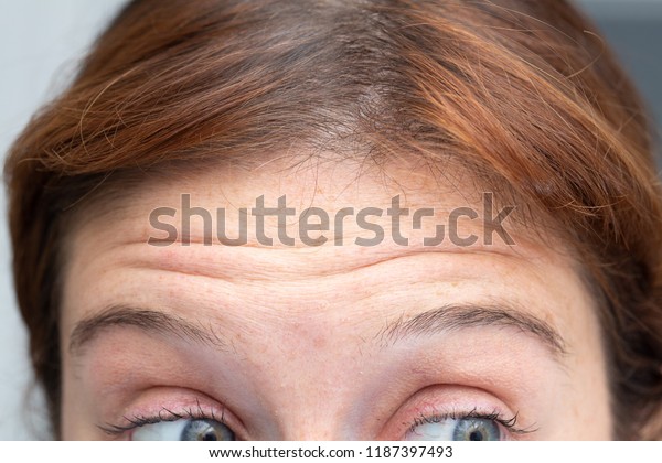 Lines of age in female\
forehead