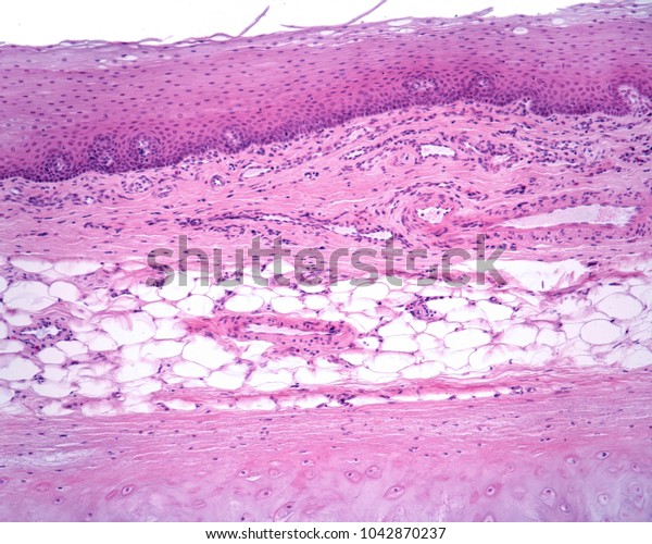 Lingual Surface Epiglottis Showing Top Bottom Stock Photo (Edit Now ...