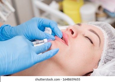 Lip Augmentation. Beautician Injects Hyaluronic Acid Into The Lips Of A Girl With A Syringe. The Cosmetologist Doctor Performs The Procedure In The Cosmetology Office. Plastic Surgery.