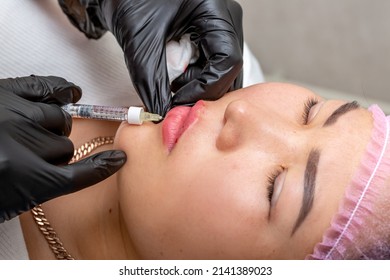 Lip Augmentation. Beautician Injects Hyaluronic Acid Into The Lips Of A Girl With A Syringe. The Cosmetologist Doctor Performs The Procedure In The Cosmetology Office. Plastic Surgery.