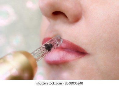 Lip augmentation treatment using needle-free mesotherapy with hyaluron pen device